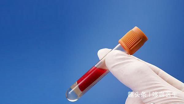 指标|引发心梗的高血脂，应该检查哪些指标