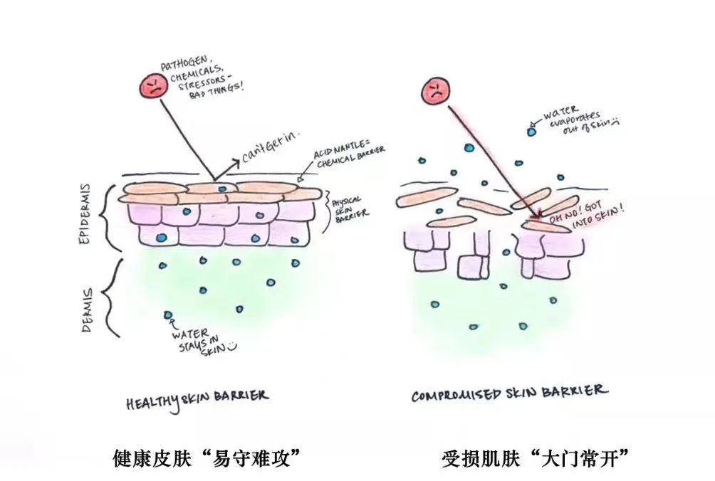 脸蛋子|我烂脸了！新年皮肤急救（完整版）