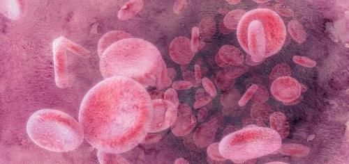 油炸食物|血脂超标怎么办?“3黄”请撤离饭桌,稳定血脂,血管可能更畅通