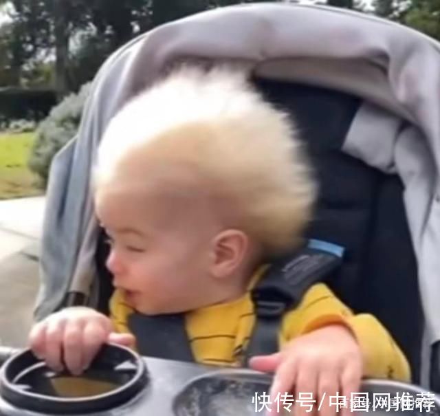 蓬发综合征|美国一男婴拥有爱因斯坦“同款发型”，全球大概有100名类似患者