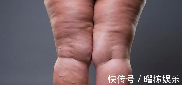 蒿坪毛尖|血压高不代表是高血压,高血压6个症状,看看你都了解么