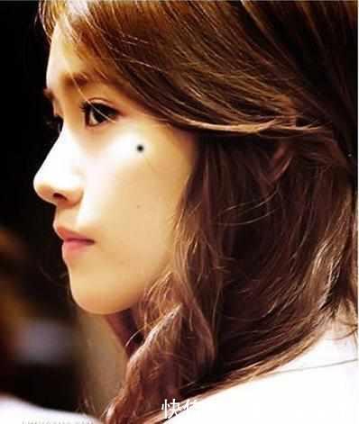 地方|这3个地方有“痣”，是“美人脸”的标志，千万别点掉了