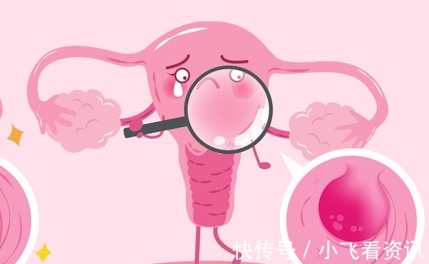 身体|身体3个地方发痒,是HPV来了,趁早去检查,别误以为是过敏