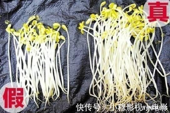 肝癌|36岁女子转氨酶高达391，确诊肝癌，医生告诫：一种家常菜是“祸根”