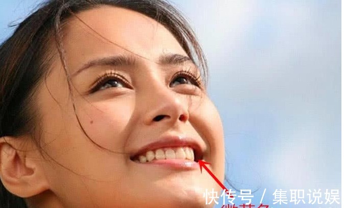 牙套|为什么明星的牙齿又白又齐, 普通人却“带点黄” 牙医给出答案