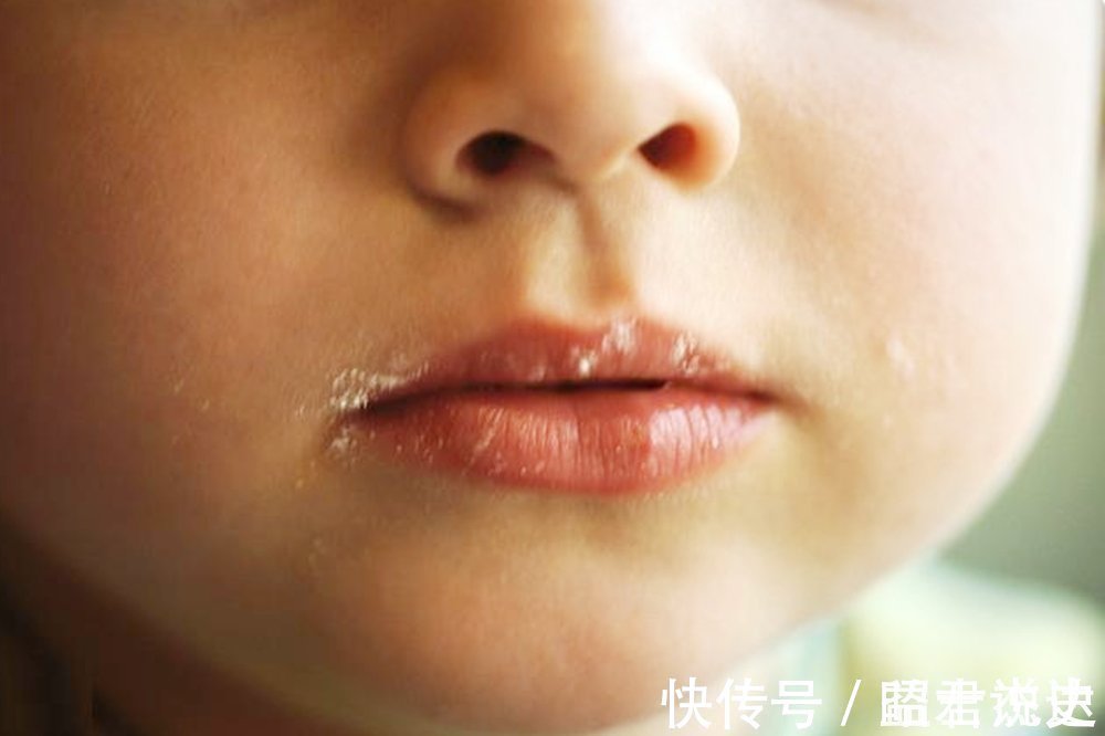 宝宝|孩子睡觉时有3个现象,说明辅食添加过度,脾胃出现问题了