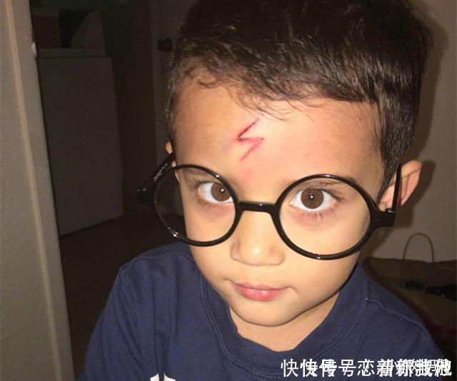 男孩不小心磕破了额头,宝妈灵机一动,让娃变成了“哈利波特”