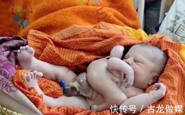 神明|印度一孕妇诞下“怪婴”，拥有4只手和4条腿，民众当神明膜拜