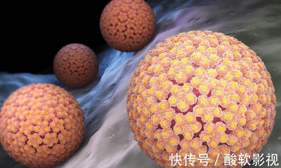 寻常疣|身体3个地方发痒，是HPV来了，趁早去检查，别误以为是过敏