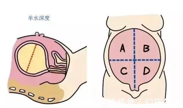 b超检查|孕期四维彩超，能看懂检查报告的这三点，胎儿或许就没有小秘密了