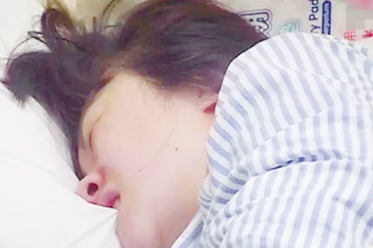 生完2胎想永久避孕，上环到底好不好该怎么选女性须知