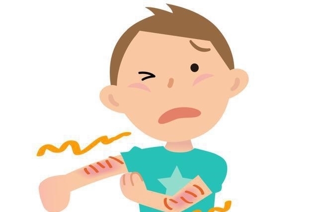 皮肤干癣还会引起关节炎,出现这些症状要小心