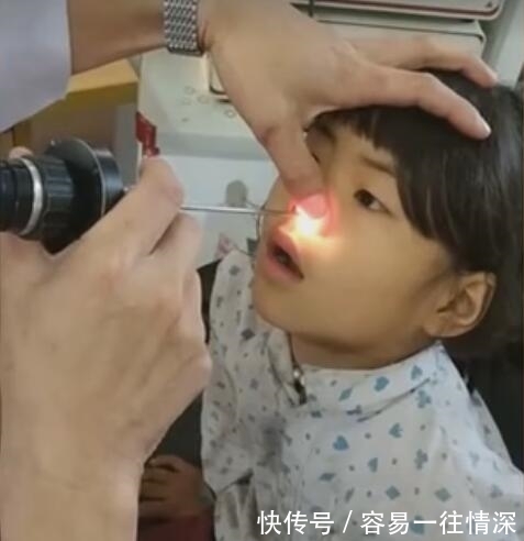 活虫子|奇闻：医生从小女孩鼻子里取出一条活虫子，女孩看见后一脸淡定