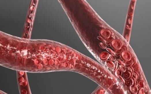 健康长寿|日本平均寿命高于我国,只因2种食物,而2种食物却产于我国!