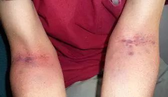 薏仁|只要经常拍几个部位，肚子就能瘦一圈，大家一起试试看吧！