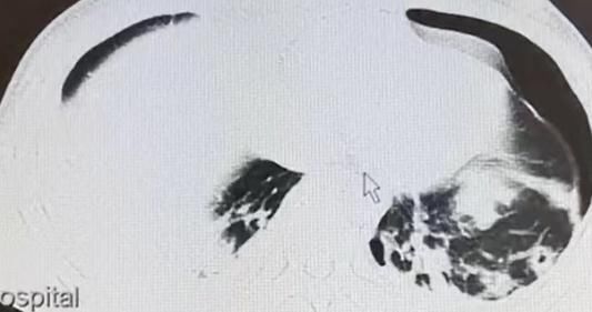 寄生虫|头皮发麻！男子吃这个东西当药引，结果身体里长满寄生虫！