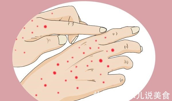 表皮|体内有癌,皮肤会打“小报告”,若没有4个异常,或可安心