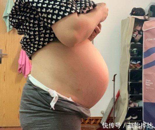 胎盘|准妈妈犯小错误，孕中期胎盘剥离，胎儿被引产