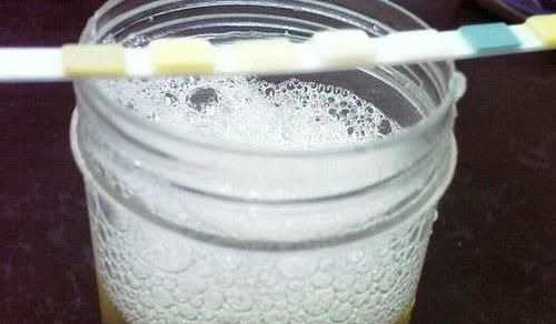 转尿毒症|糖尿病人若发生此些变化，说明有转尿毒症的迹象，还好早清楚了