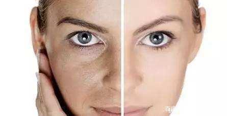 晒黑了多久能恢复怎么快速变白