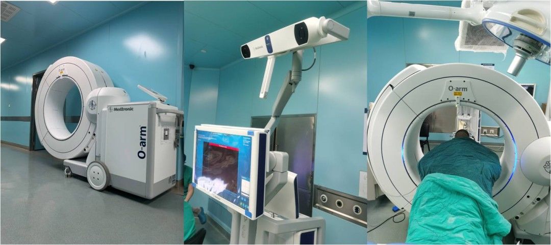 植入|“脖子断了”还能活吗？浦东医生用高科技把患者从“鬼门关”拉回