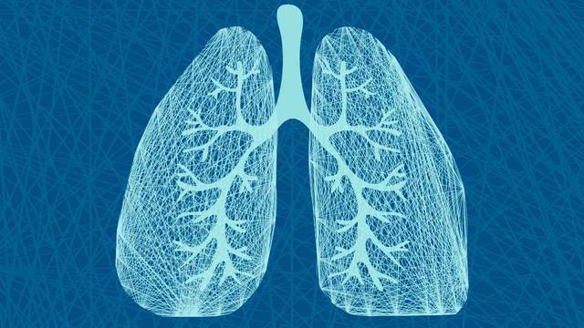 结节|体检发现肺结节,如何进一步检查以排除肺癌大夫建议您这么做!