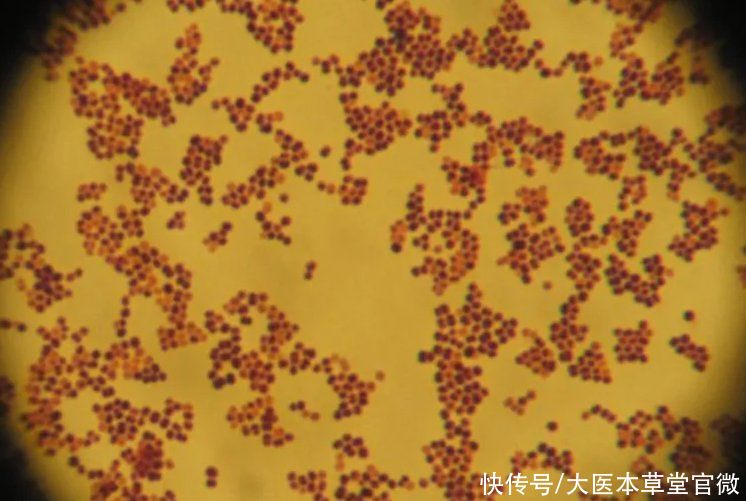 成分|反复口腔溃疡，这2种细菌不注意，用多少药都没用