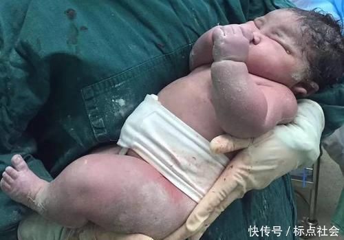 生产方式|顺产还是剖腹产?医生:想顺产,必须满足5点,缺一点都不少受罪