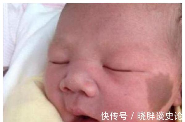 小女孩|宝宝的胎记怎么来的?产科医生:孕期这2种行为易长胎记,要避开