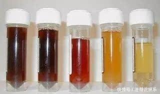 喝水|嘴唇总是干裂没亮泽不只是缺水,还跟缺乏一种营养素有关