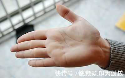 生活环境|寿命短的人,往往身上四处发白,若一个不占,说明身体更健康长寿