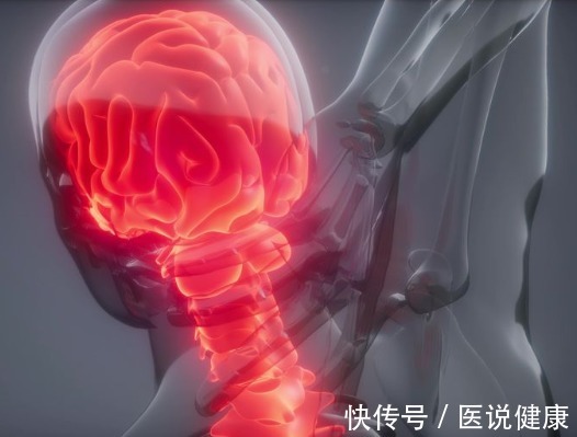 头痛|3个症状突然找上自己,当心是脑血管痉挛的征兆,劝你趁早检查