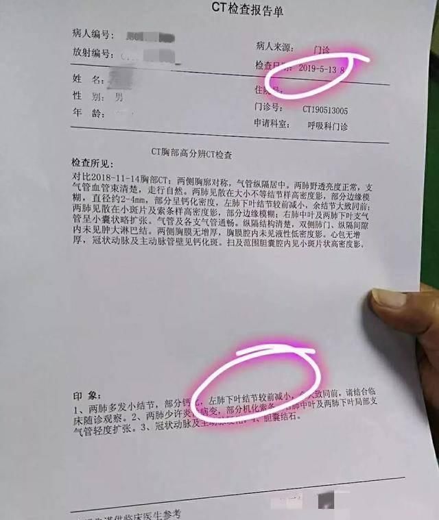 醫生說，發現肺結節基本沒啥大事，但出現這5個癥狀要及時防治！