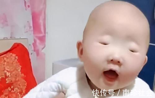 爱美之心|孩子出生眼睛太小,宝妈赶忙去找医生询问,医生却笑了
