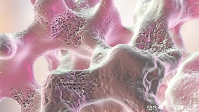 腰酸背痛|骨科院士建议:3个习惯坚持2个月,骨密度蹭蹭长,骨骼坚如磐石