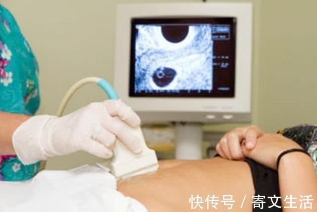 宫外孕|孕期第一次产检中，这三个指标合格，恭喜你，说明胎儿发育健康