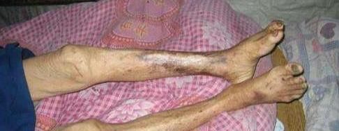 中医基础理论|三处肉“塌下来”,人就彻底老了,不妨自测下自己看看