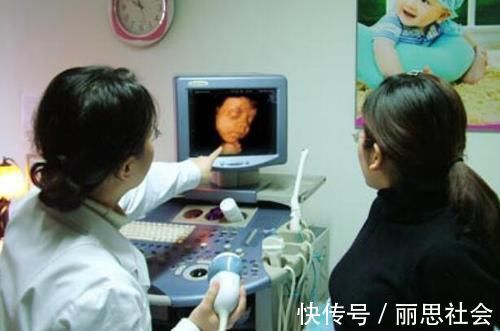 检查|唐筛数值能查胎儿“畸形”,但看男宝宝和女宝宝准吗?孕妈了解下