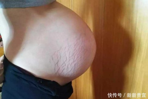 四维彩超一次过,准妈妈应该感谢它,窃喜吧