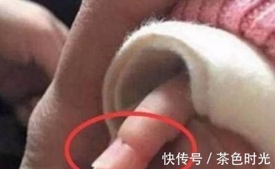 宝妈|妈妈发现宝宝身上长一圈圈的,不知是啥,医生检查后母亲却大哭!