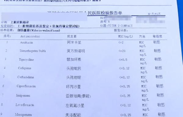 病死率|男子买鱼做大餐却被送进ICU,这个动作害了他