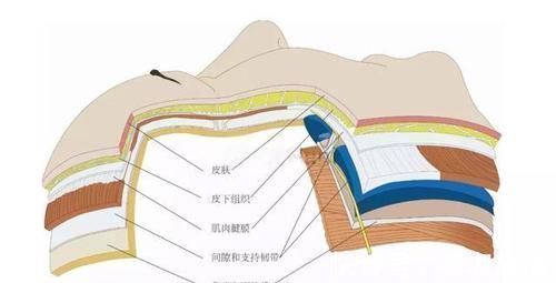 微创 聊一聊除了拉皮手术,微创小切口提升怎么样?多大年纪适合做?