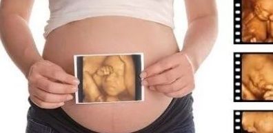 做四维时，小家伙在肚子里干起了坏事，能不能不要这么搞笑