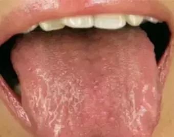 盗汗|油尽灯枯的你是阴虚了吗？默默教你用对调理方法，一周就能调回来