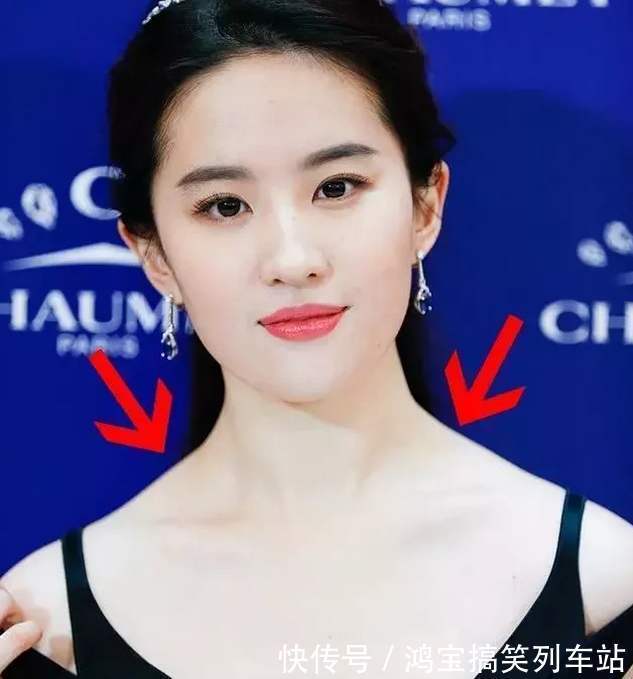 斜方肌 担心溜肩穿衣不好看?你得选这几件单品才能扬长避短,穿出时髦感