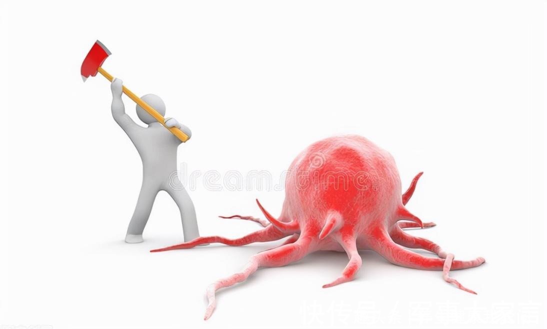 李明|打破肺癌晚期最多存活半年“魔咒”，晚期癌症带瘤生存4年病例