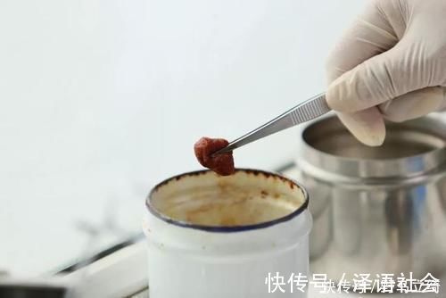 急救|4岁宝宝掉入170度油锅,奶奶3步救下孩子,医生:急救措施很专业