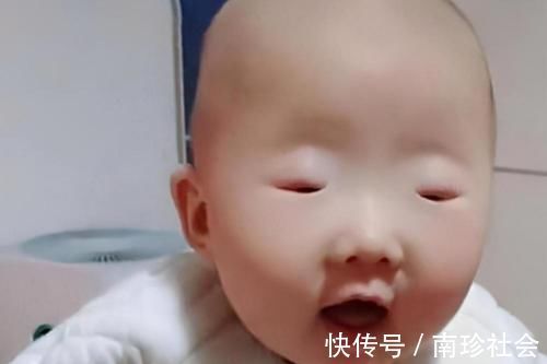 爱美之心|孩子出生眼睛太小,宝妈赶忙去找医生询问,医生却笑了