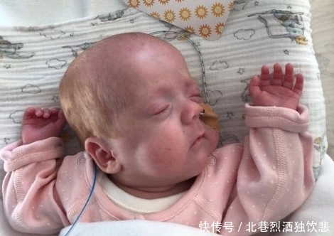 周生|准妈妈孕24周生下1斤4两宝宝 现健康回家;父母做法令人感动