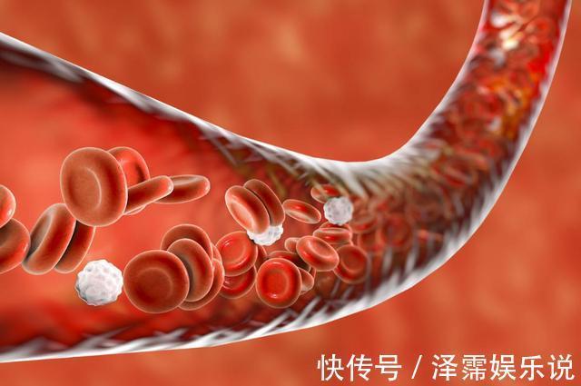 血脂|高血脂不能吃鸡蛋91岁内科院士忠告若想血管健康,远离4物